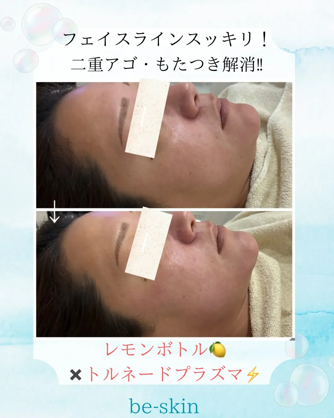 レモンボトル🍋✖️トルネードプラズマ⚡️