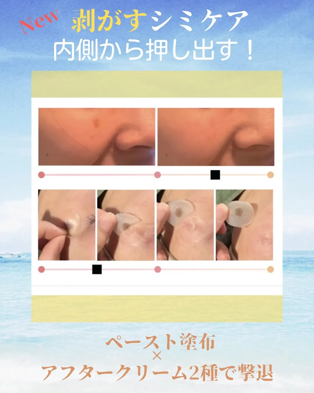 New!! 剥がす・内側から押し出すシミケア！