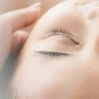 ニキビ
